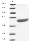 (Tris-Glycine gel) Discontinuous SDS-PAGE (reduced) with 5% enrichment gel and 15% separation gel.