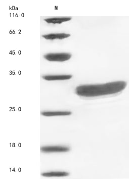 (Tris-Glycine gel) Discontinuous SDS-PAGE (reduced) with 5% enrichment gel and 15% separation gel.
