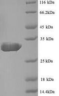 Recombinant Escherichia coli Beta-lactamase TEM (bla) – Figure 1 of 1
