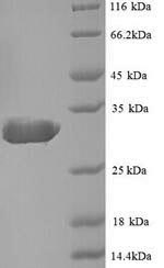 Recombinant Escherichia coli Beta-lactamase TEM (bla) – Figure 1 of 1