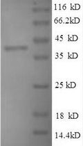 Recombinant Mycobacterium tuberculosis PeptiDoglycan-binding protein ArfA (arfA) – Figure 1 of 1