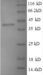 Recombinant Mycobacterium tuberculosis PeptiDoglycan-binding protein ArfA (arfA) – Figure 1 of 1