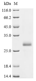 (Tris-Glycine gel) Discontinuous SDS-PAGE (reduced) with 5% enrichment gel and 15% separation gel.