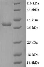 Recombinant Escherichia coli Methyl-accepting chemotaxis protein I (tsr), partial – Figure 1 of 1