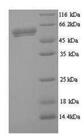 Recombinant Human respiRatory syncytial virus A Fusion glycoprotein F0 (F), partial – Figure 1 of 1