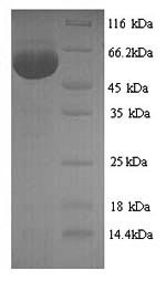 Recombinant Influenza A virus Nucleoprotein (NP) – Figure 1 of 1