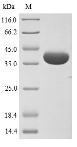 (Tris-Glycine gel) Discontinuous SDS-PAGE (reduced) with 5% enrichment gel and 15% separation gel.