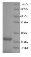 Recombinant Influenza B virus Nucleoprotein (NP), partial – Figure 1 of 1