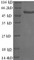 Recombinant Saccharomyces cerevisiae Alpha-galactosidase 1 (MEL1) – Figure 1 of 1