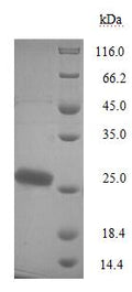 Recombinant Bordetella pertussis Pertussis toxin subunit 1 (ptxA) – Figure 1 of 1