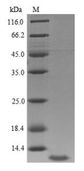 (Tris-Glycine gel) Discontinuous SDS-PAGE (reduced) with 5% enrichment gel and 15% separation gel.
