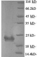 Recombinant Bordetella pertussis Serotype 2 fimbrial subunit (fim2) – Figure 1 of 1
