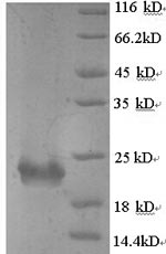 Recombinant Bordetella pertussis Serotype 2 fimbrial subunit (fim2) – Figure 1 of 1