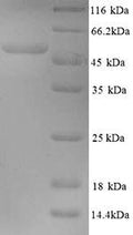 Recombinant Human papillomavirus type 18 Minor capsid protein L2 (L2) – Figure 1 of 1