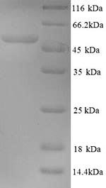 Recombinant Human papillomavirus type 18 Minor capsid protein L2 (L2) – Figure 1 of 1