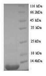 Recombinant Enterobacteria phage 933W Shiga-like toxin 2 subunit B (stxB2) – Figure 1 of 1