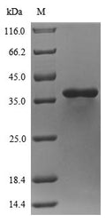 (Tris-Glycine gel) Discontinuous SDS-PAGE (reduced) with 5% enrichment gel and 15% separation gel.