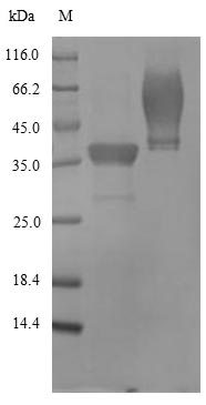 (Tris-Glycine gel) Discontinuous SDS-PAGE (reduced) with 5% enrichment gel and 15% separation gel.
