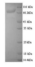 Recombinant Bacillus thuringiensis subsp. Pesticidal crystal protein cry3Aa (cry3Aa) – Figure 1 of 1