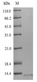 (Tris-Glycine gel) Discontinuous SDS-PAGE (reduced) with 5% enrichment gel and 15% separation gel.