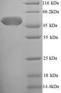 Recombinant Escherichia coli Chaperone surA (surA) – Figure 1 of 1