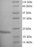 Recombinant Escherichia coli O6:H1 Lipopolysaccharide export system protein LptC (lptC) – Figure 1 of 1