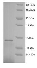Recombinant Human Interferon alpha-2 (IFNA2) – Figure 1 of 1