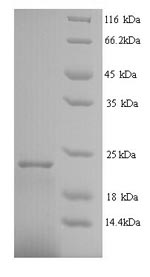 Recombinant Human Interferon alpha-2 (IFNA2) – Figure 1 of 1