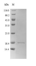 Recombinant Mouse Hemoglobin subunit beta-2 (Hbb-b2) – Figure 1 of 1
