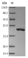 (Tris-Glycine gel) Discontinuous SDS-PAGE (reduced) with 5% enrichment gel and 15% separation gel.