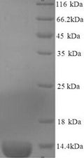 Recombinant Mouse Serum amyloid A-3 protein (Saa3), partial – Figure 1 of 1