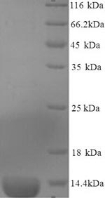 Recombinant Mouse Serum amyloid A-3 protein (Saa3), partial – Figure 1 of 1