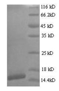 Recombinant Human papillomavirus type 18 Protein E7 (E7) – Figure 1 of 1