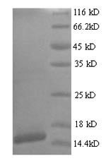 Recombinant Human papillomavirus type 18 Protein E7 (E7) – Figure 1 of 1