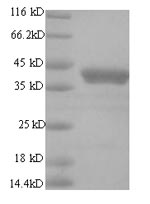 Recombinant Human papillomavirus type 18 Regulatory protein E2 (E2) – Figure 1 of 1