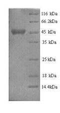 Recombinant Escherichia coli NAD (P) transhydrogenase subunit alpha (pntA), partial – Figure 1 of 1
