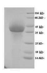 (Tris-Glycine gel) Discontinuous SDS-PAGE (reduced) with 5% enrichment gel and 15% separation gel.
