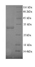 Recombinant Escherichia coli Type 1 fimbrin D-mannose specific adhesin (fimH) – Figure 1 of 1