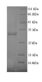 Recombinant Escherichia coli Type 1 fimbrin D-mannose specific adhesin (fimH) – Figure 1 of 1