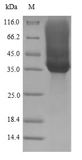 (Tris-Glycine gel) Discontinuous SDS-PAGE (reduced) with 5% enrichment gel and 15% separation gel.