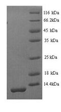 Recombinant Mouse Serine protease inhibitor Kazal-type 1 (Spink1) – Figure 1 of 1