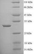 Recombinant Mycobacterium tuberculosis Enoyl-[acyl-carrier-protein] reductase [NADH] (inhA) – Figure 1 of 1