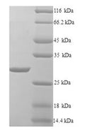 Recombinant Klebsiella pneumoniae Beta-lactamase SHV-1 (bla) – Figure 1 of 1