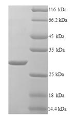 Recombinant Klebsiella pneumoniae Beta-lactamase SHV-1 (bla) – Figure 1 of 1