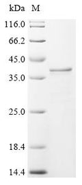 (Tris-Glycine gel) Discontinuous SDS-PAGE (reduced) with 5% enrichment gel and 15% separation gel.