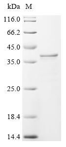 (Tris-Glycine gel) Discontinuous SDS-PAGE (reduced) with 5% enrichment gel and 15% separation gel.