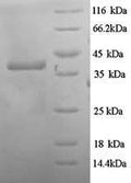 Recombinant Escherichia coli Hygromycin-B 4-O-kinase (hph) – Figure 1 of 1