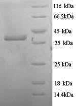 Recombinant Escherichia coli Hygromycin-B 4-O-kinase (hph) – Figure 1 of 1