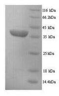 Recombinant Mouse H-2 class I histocompatibility antigen, D-D alpha chain (H2-D1), partial – Figure 1 of 1