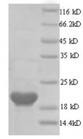 Recombinant Human papillomavirus type 16 Protein E6 (E6) – Figure 1 of 1
